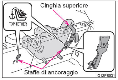 Uso di una staffa di ancoraggio (per la cinghia superiore)